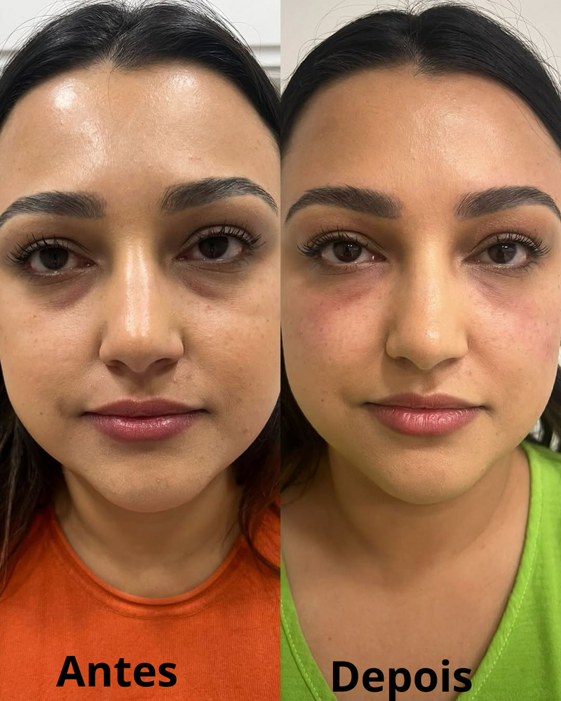 Creme para os Olhos Peter Thomson – Resultados Visíveis Já na Primeira Aplicação!